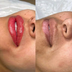 Avant après de la prestation Candy Lips ADR By Floriane à Valence, maquillage permanent des lèvres pour un effet coloré, pulpeux et naturel.